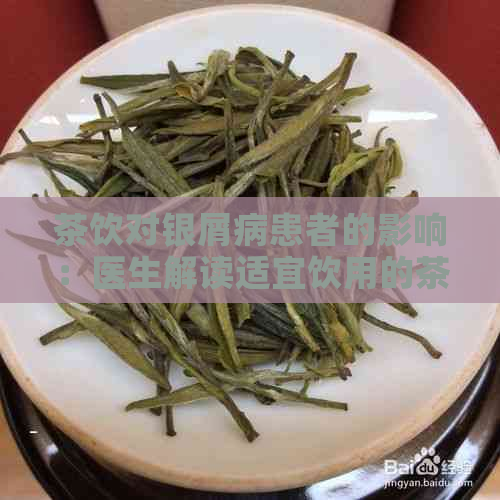 茶饮对银屑病患者的影响：医生解读适宜饮用的茶叶种类