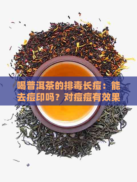 喝普洱茶的排长痘：能去痘印吗？对痘痘有效果吗？