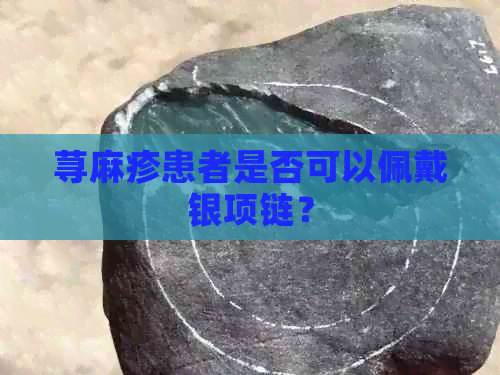 荨麻疹患者是否可以佩戴银项链？