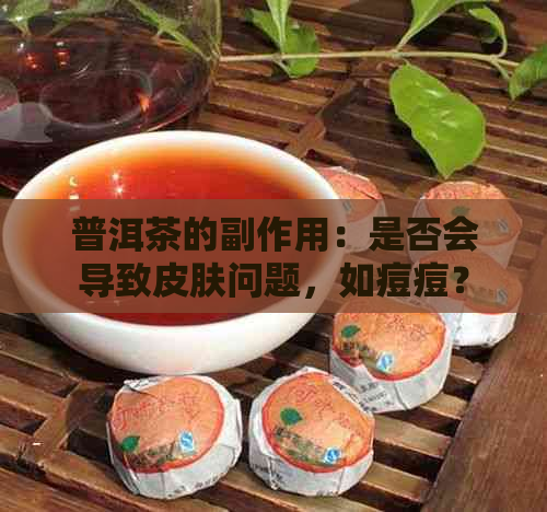 普洱茶的副作用：是否会导致皮肤问题，如痘痘？