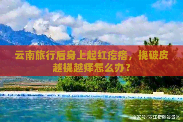 云南旅行后身上起红疙瘩，挠破皮越挠越痒怎么办？