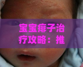 宝宝痱子治疗攻略：推荐适用的止痱产品与方法