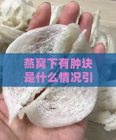 燕窝下有肿块是什么情况引起的及治疗与处理方法