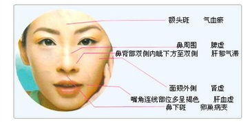 揭秘：人脸上的燕窝之称及其成因与处理方法全解析