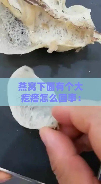 燕窝下面有个大疙瘩怎么回事：旁边有可推动小疙瘩，大小不一，有时疼痛