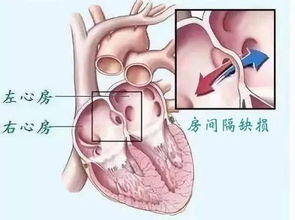 燕窝食用后胸部不适原因解析及应对方法全解析