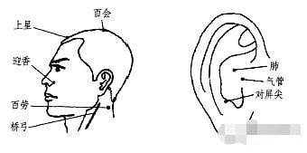 燕窝对支气管炎的作用：功效与有效性探究