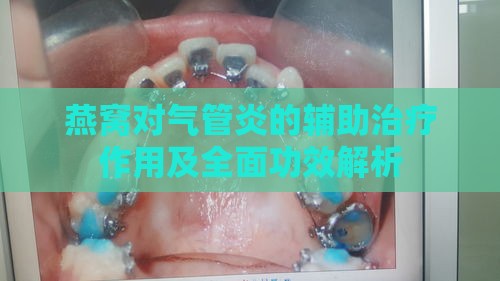 燕窝对气管炎的辅助治疗作用及全面功效解析