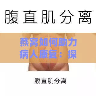 燕窝如何助力病人康复：探讨其神奇功效与作用