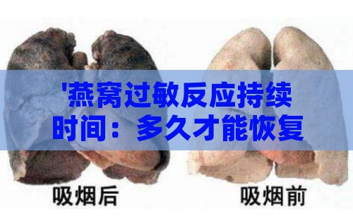 '燕窝过敏反应持续时间：多久才能恢复正常状态'