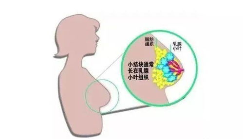 揭秘人脸燕窝现象：原因、症状及解决方法的全面解析