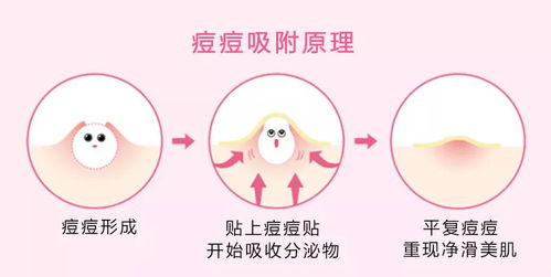 送丈母娘燕窝合适吗：女方、女生看法及是否好的全面分析