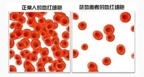 探究燕窝过量食用引起的症状及其成因分析