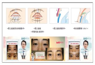 探寻眼眸奥秘：眼下的凹陷部位学名揭秘