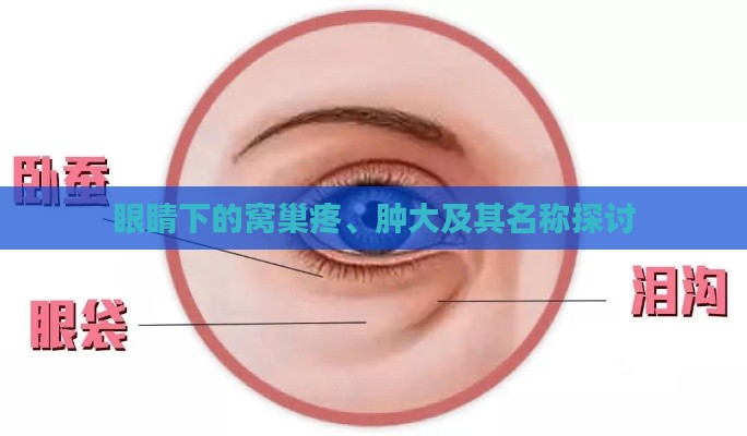 眼睛下的窝巢疼、肿大及其名称探讨