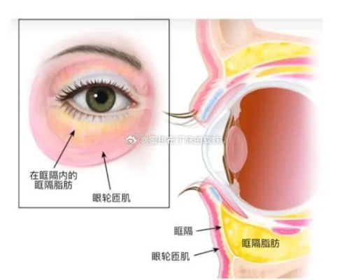 眼睛下的窝巢疼、肿大及其名称探讨