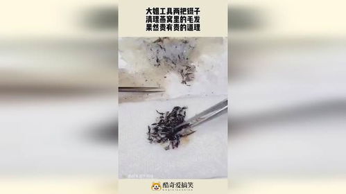 买燕窝去毛的镊子叫什么