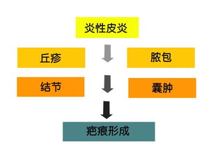 详探燕窝的多种正宗形态与色彩：全面指南解析燕窝外观特征与鉴别方法