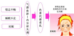 探究女性身体上的'燕窝'现象：含义、原因及解决方法全解析