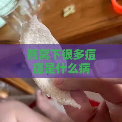 燕窝下很多痘痘是什么病