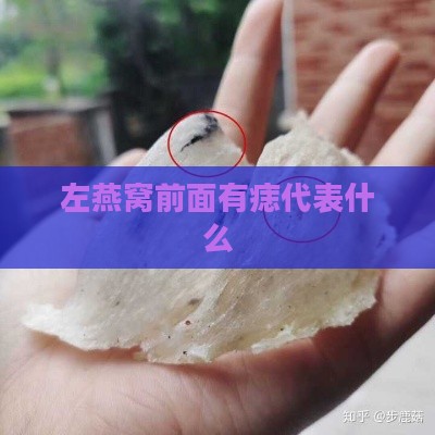 左燕窝前面有痣代表什么